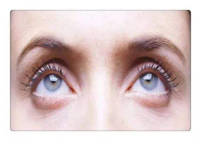 提高記憶力的藥吃了真的有用嗎?這些藥有副作用嗎?